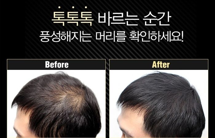 <font color=#C72700>25%할인</font> 다슈 탈모 완벽 커버 '헤어쿠션'